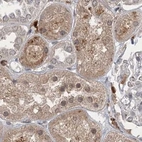 Immunohistochemical staining of human kidney using Anti-NAGK antibody HPA035207.