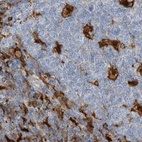 Immunohistochemical staining of human tonsil using Anti-NAGK antibody HPA035206.