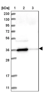 Lane 1: Marker [kDa] 230, 130, 95, 72, 56, 36, 28, 17, 11_br/_Lane 2: Human cell line RT-4_br/_Lane 3: Human cell line U-251 MG