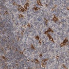 Immunohistochemical staining of human tonsil using Anti-NAGK antibody HPA035207.