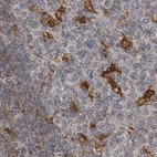 Immunohistochemical staining of human tonsil using Anti-NAGK antibody HPA035207.