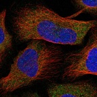 Immunofluorescent staining of human cell line U-2 OS shows localization to cytosol.