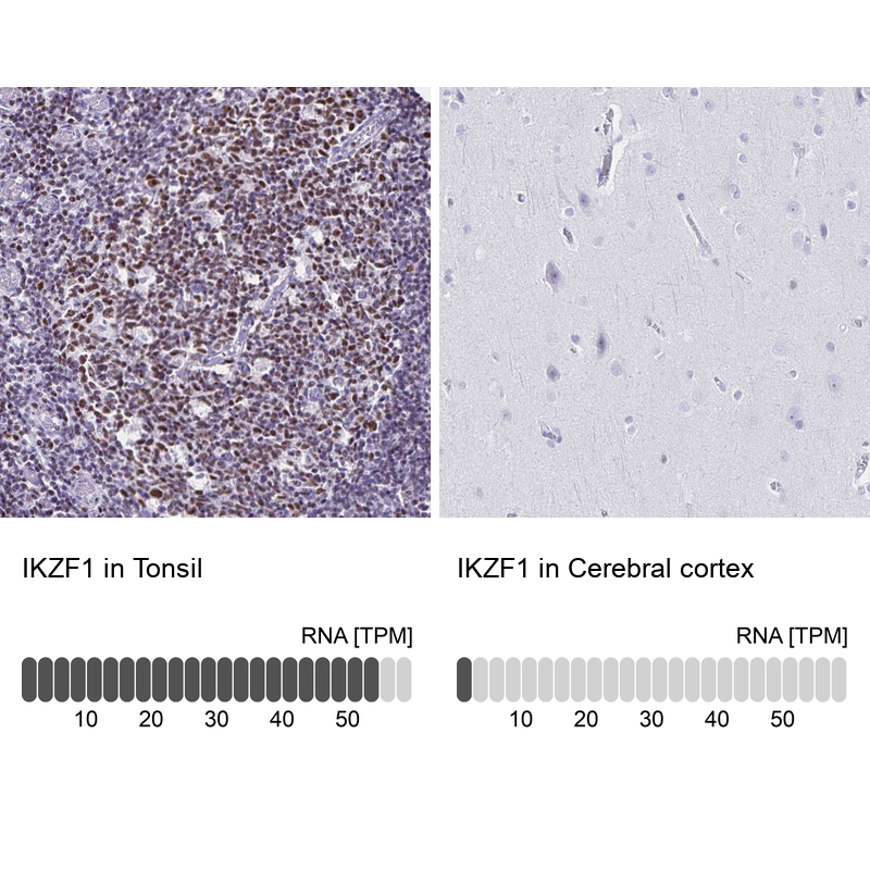 Anti-IKZF1 Antibody