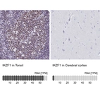 Anti-IKZF1 Antibody