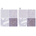 Immunohistochemical staining of human cerebral cortex, kidney, testis and tonsil using Anti-IKZF1 antibody HPA035222 (A) shows similar protein distribution across tissues to independent antibody HPA035221 (B).