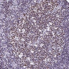 Immunohistochemical staining of human tonsil shows strong nuclear positivity in germinal center cells.