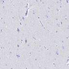 Immunohistochemical staining of human cerebral cortex shows no positivity in neurons as expected.