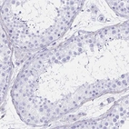 Immunohistochemical staining of human testis shows no positivity in cells in seminiferous ducts as expected.