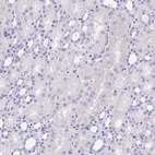 Immunohistochemical staining of human kidney shows no positivity in cells in tubules as expected.
