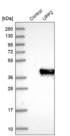 Anti-UPP2 Antibody