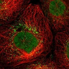 Immunofluorescent staining of human cell line A-431 shows localization to nucleus & vesicles.
