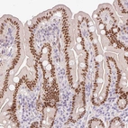 Immunohistochemical staining of human small intestine shows strong nuclear positivity in glandular cells.