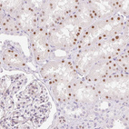 Anti-HNF1A Antibody