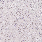 Immunohistochemical staining of human liver shows weak nuclear positivity in hepatocytes.