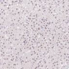 Immunohistochemical staining of human liver shows weak nuclear positivity in hepatocytes.