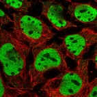 Immunofluorescent staining of human cell line CACO-2 shows localization to nucleoplasm.