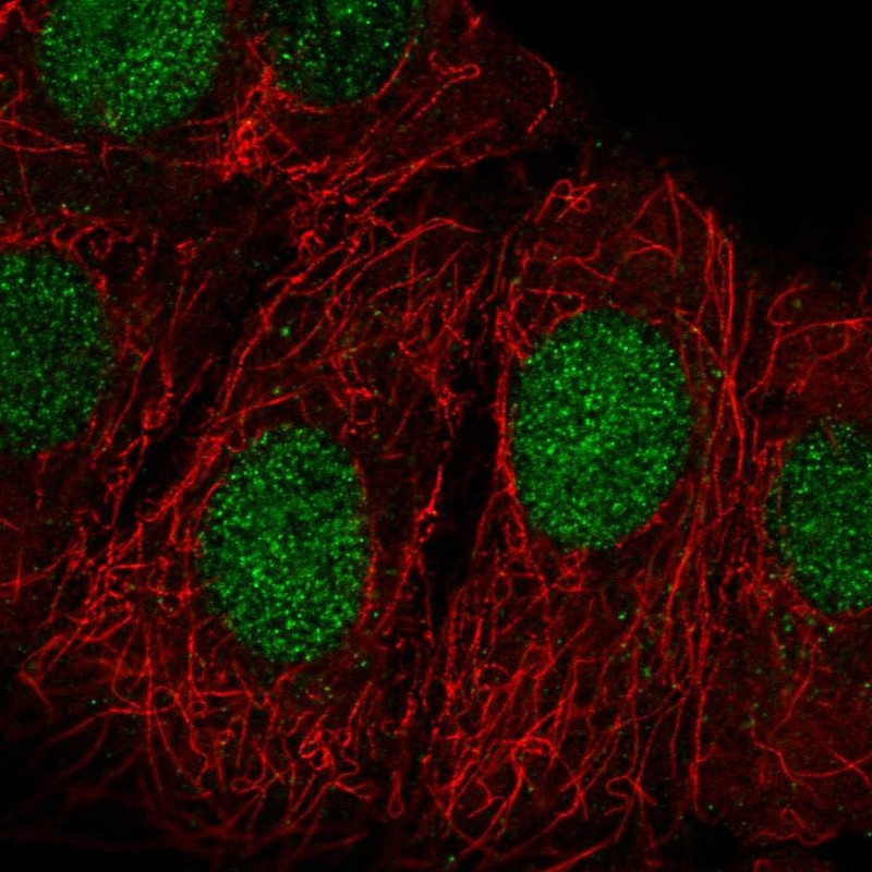 Anti-ZRANB3 Antibody