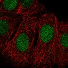 Anti-ZRANB3 Antibody