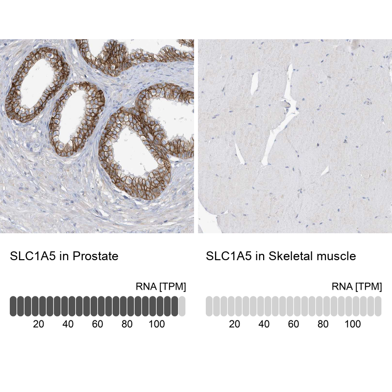 Anti-SLC1A5 Antibody