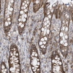 Immunohistochemical staining of human rectum shows moderate to strong membranous positivity in glandular cells.