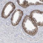 Immunohistochemical staining of human prostate shows strong membranous positivity in glandular cells.