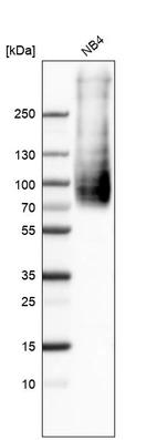 Western blot analysis in human cell line NB4.