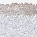 Immunohistochemical staining of human urinary bladder shows weak membranous positivity in urothelial cells.