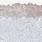 Immunohistochemical staining of human urinary bladder shows weak membranous positivity in urothelial cells.
