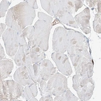 Immunohistochemical staining of human skeletal muscle shows no positivity in myocytes as expected.