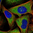Immunofluorescent staining of human cell line U-2 OS shows localization to cytosol & vesicles.
