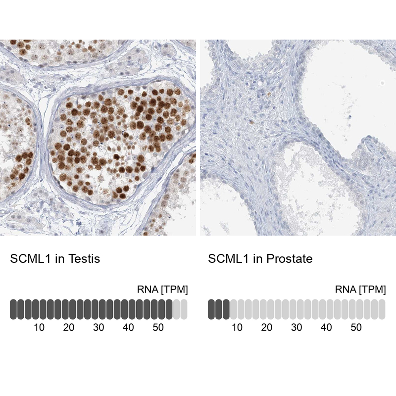 Anti-SCML1 Antibody
