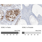 Anti-SCML1 Antibody