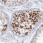 Immunohistochemical staining of human testis shows high expression.