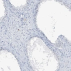 Immunohistochemical staining of human prostate shows low expression as expected.