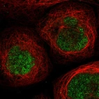Immunofluorescent staining of human cell line A-431 shows localization to nucleus & nucleoli.