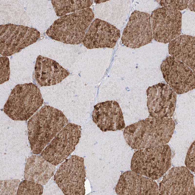 Anti-TRMU Antibody