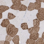 Anti-TRMU Antibody