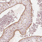 Anti-GORASP2 Antibody