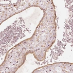 Immunohistochemical staining of human placenta shows moderate positivity in golgi apparatus in trophoblastic cells.