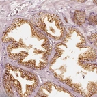Immunohistochemical staining of human prostate shows moderate positivity in golgi apparatus in glandular cells.