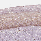 Immunohistochemical staining of human cervix, uterine shows moderate positivity in golgi apparatus in squamous epithelial cells.