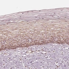 Immunohistochemical staining of human cervix, uterine shows moderate positivity in golgi apparatus in squamous epithelial cells.