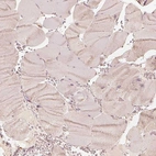 Immunohistochemical staining of human skeletal muscle shows no positivity in myocytes as expected.