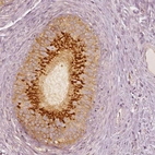 Immunohistochemical staining of human epididymis shows moderate to strong positivity in golgi apparatus in glandular cells.