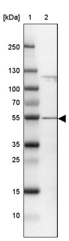 Lane 1: Marker [kDa] 250, 130, 100, 70, 55, 35, 25, 15, 10_br/_Lane 2: Human cell line U-2 OS
