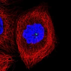 Immunofluorescent staining of human cell line A-431 shows localization to centrosome.