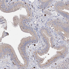 Anti-IL1RAP Antibody