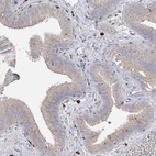Anti-IL1RAP Antibody