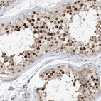 Anti-ACYP2 Antibody