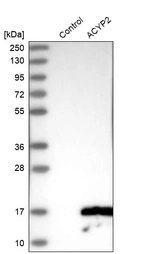 Western blot analysis in control (vector only transfected HEK293T lysate) and ACYP2 over-expression lysate (Co-expressed with a C-terminal myc-DDK tag (~3.1 kDa) in mammalian HEK293T cells, LY408599).